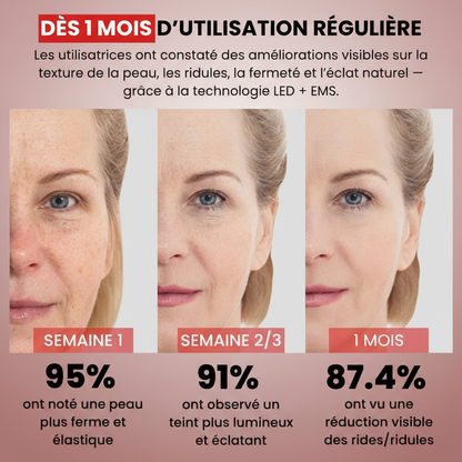 Résultats 1 mois